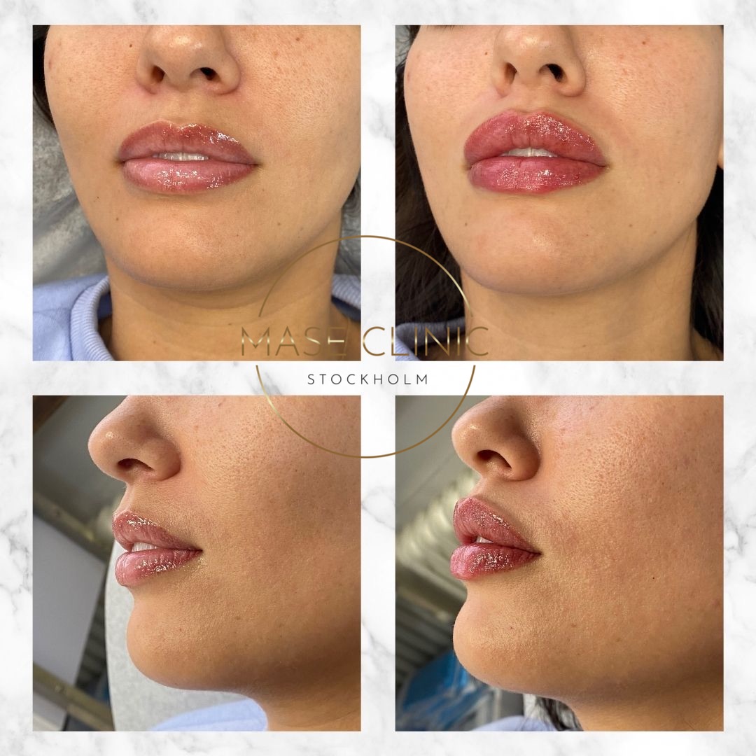 Mase Clinic, Stockholm Bokadirekt