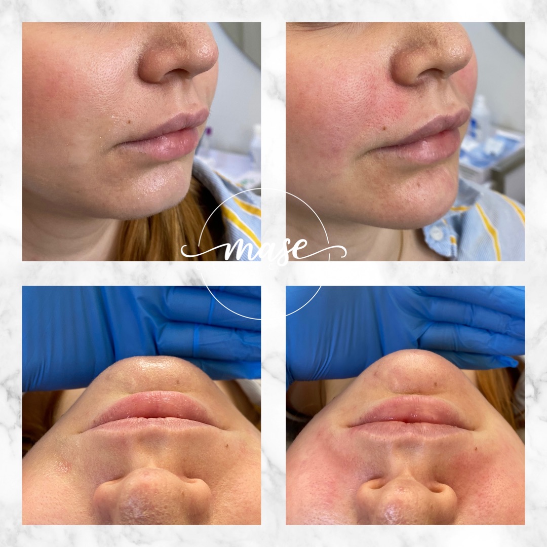 Mase Clinic, Stockholm Bokadirekt