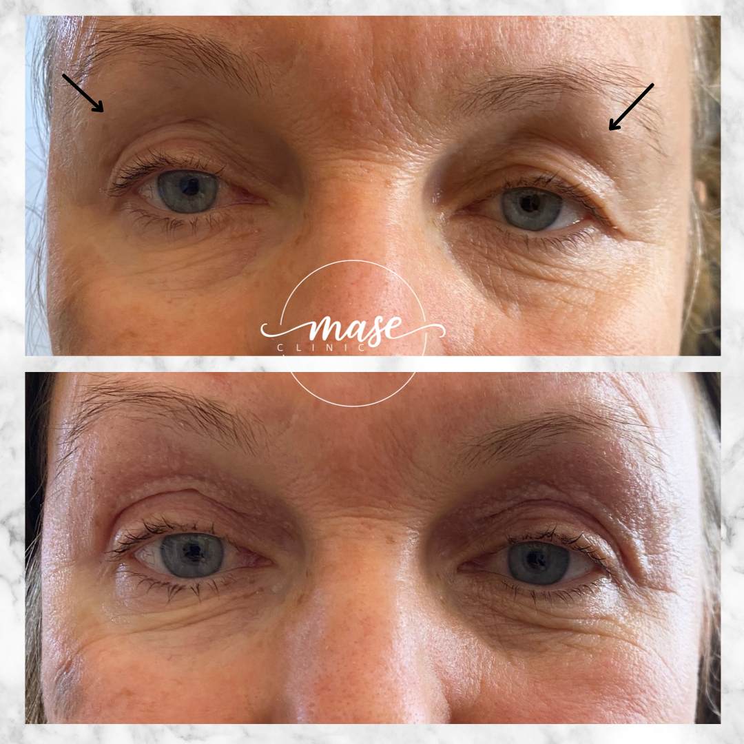 Mase Clinic, Stockholm Bokadirekt