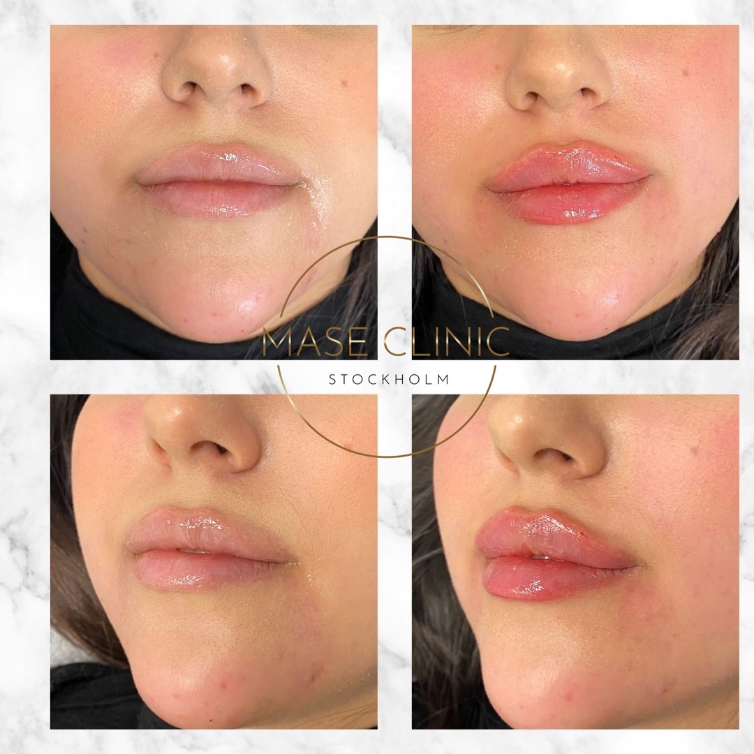 Mase Clinic, Stockholm Bokadirekt