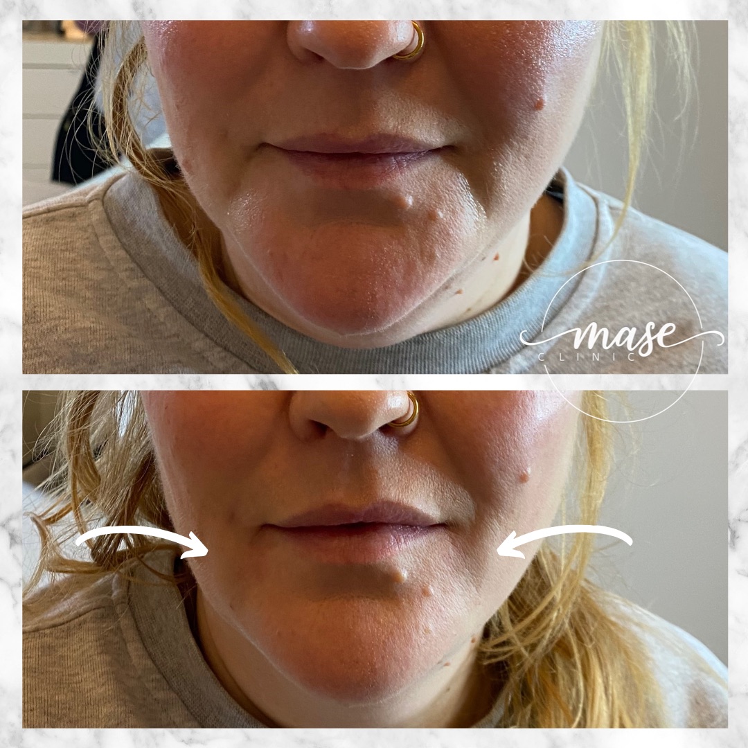 Mase Clinic, Stockholm Bokadirekt