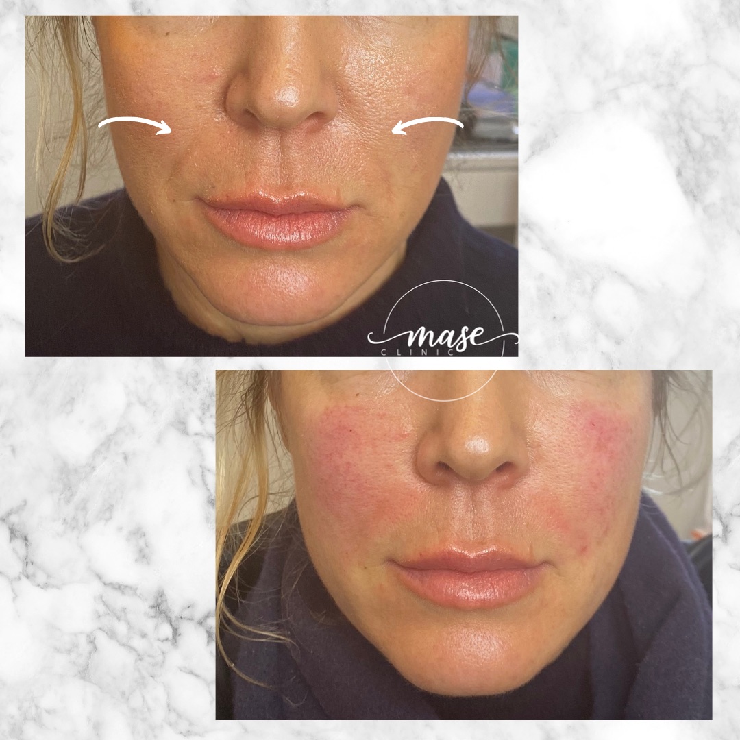 Mase Clinic, Stockholm Bokadirekt