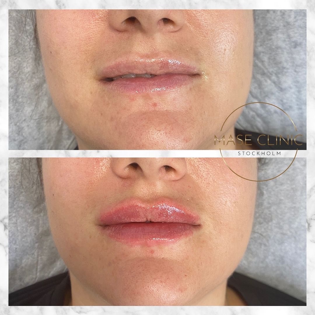 Mase Clinic, Stockholm Bokadirekt