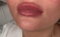 Fillers by Linda/Lindas fotstuga