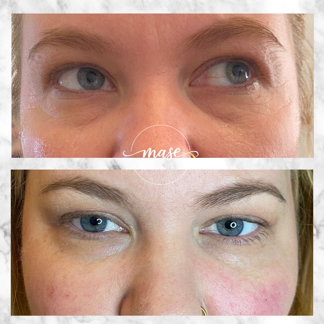 Mase Clinic, Stockholm Bokadirekt