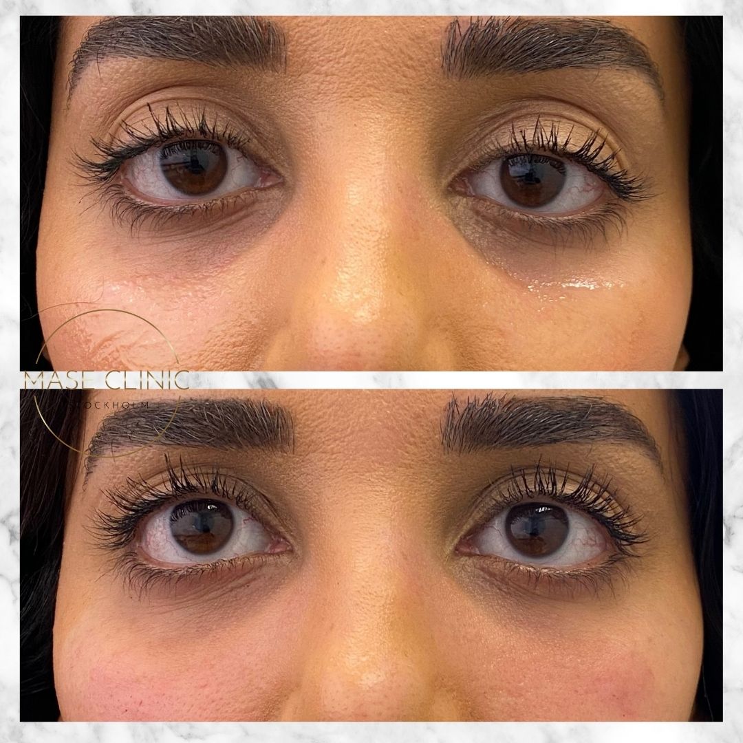 Mase Clinic, Stockholm Bokadirekt