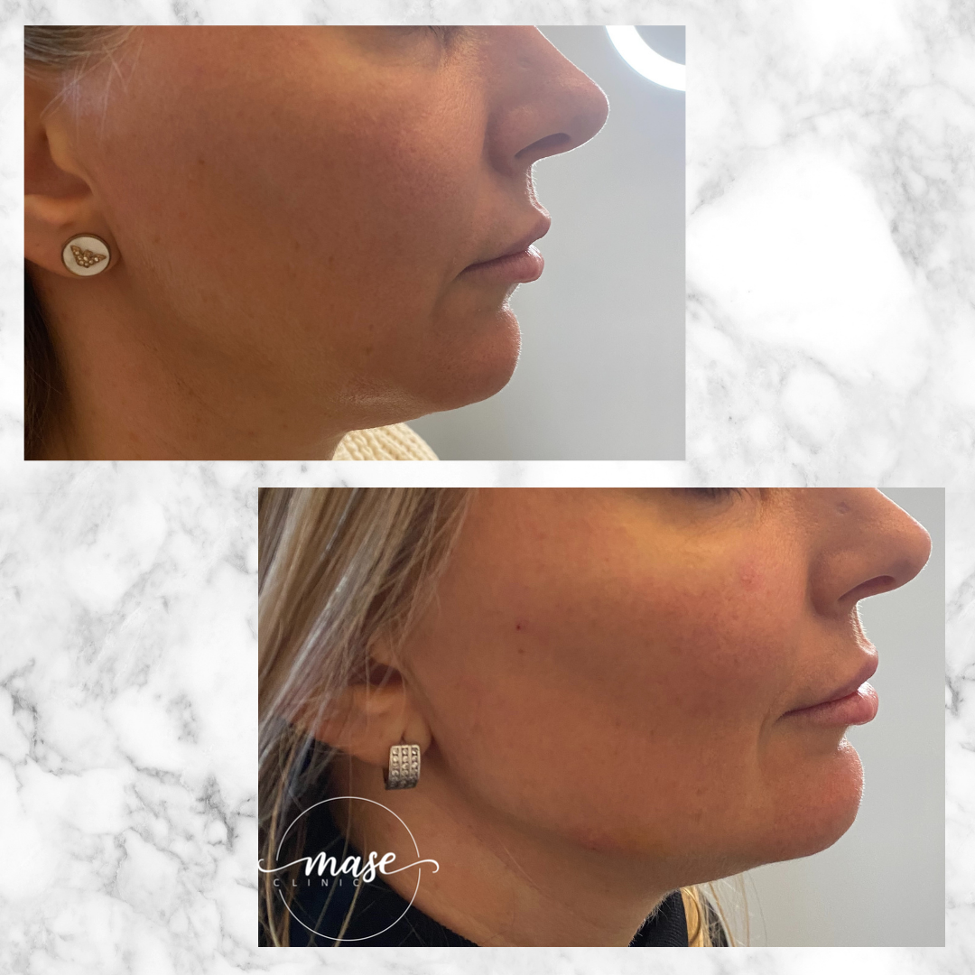 Mase Clinic, Stockholm Bokadirekt