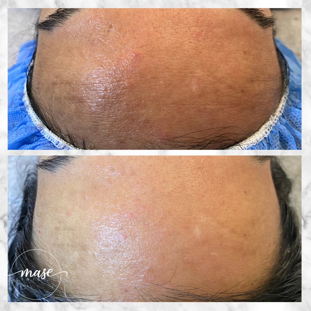 Mase Clinic, Stockholm Bokadirekt