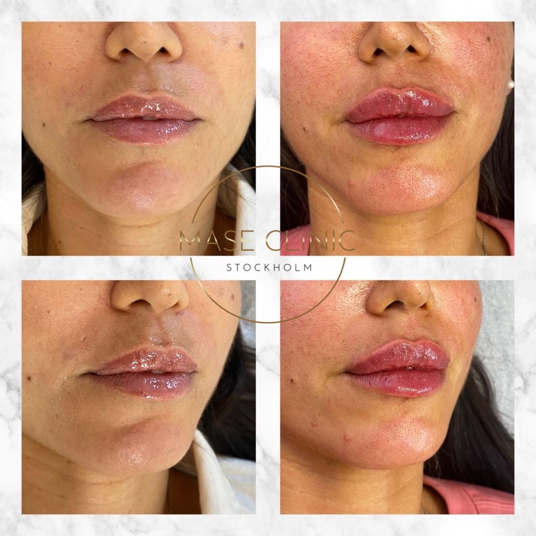 Mase Clinic, Stockholm Bokadirekt