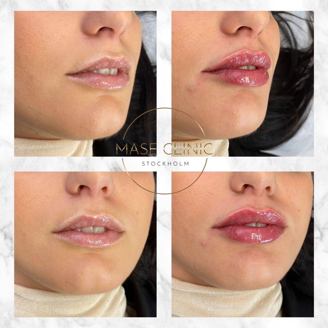 Mase Clinic, Stockholm Bokadirekt