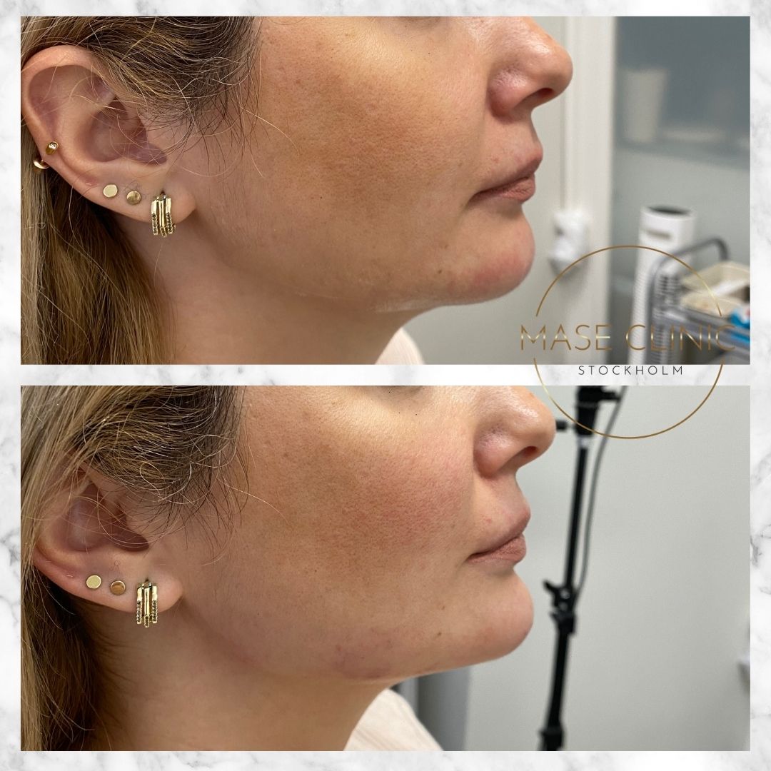 Mase Clinic, Stockholm Bokadirekt