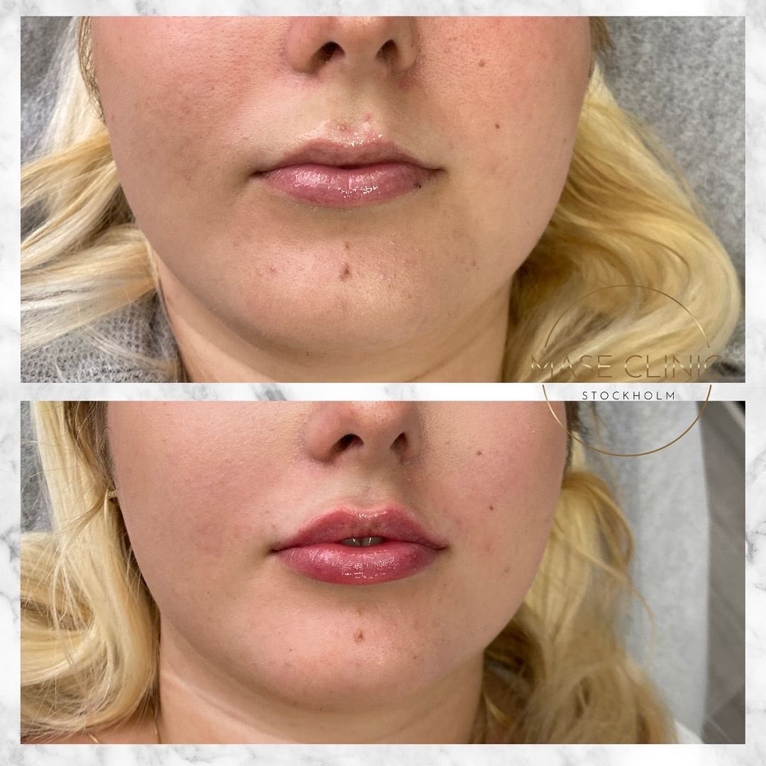 Mase Clinic, Stockholm Bokadirekt