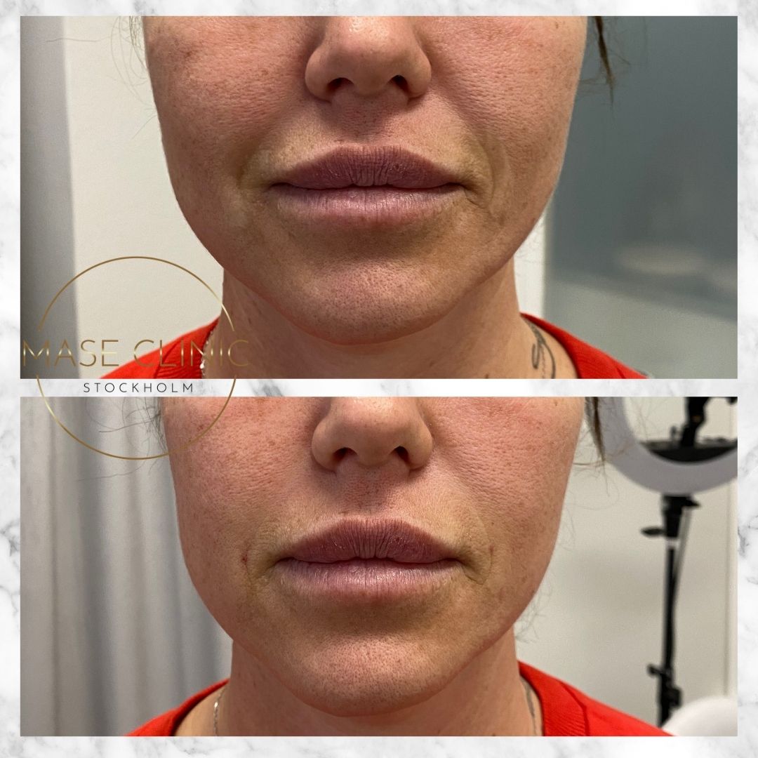 Mase Clinic, Stockholm Bokadirekt