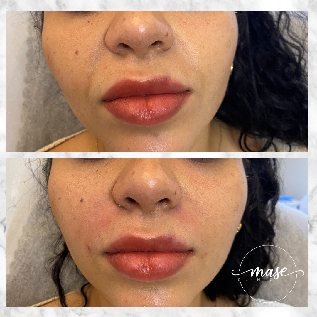 Mase Clinic, Stockholm, Kungsholmen Bokadirekt