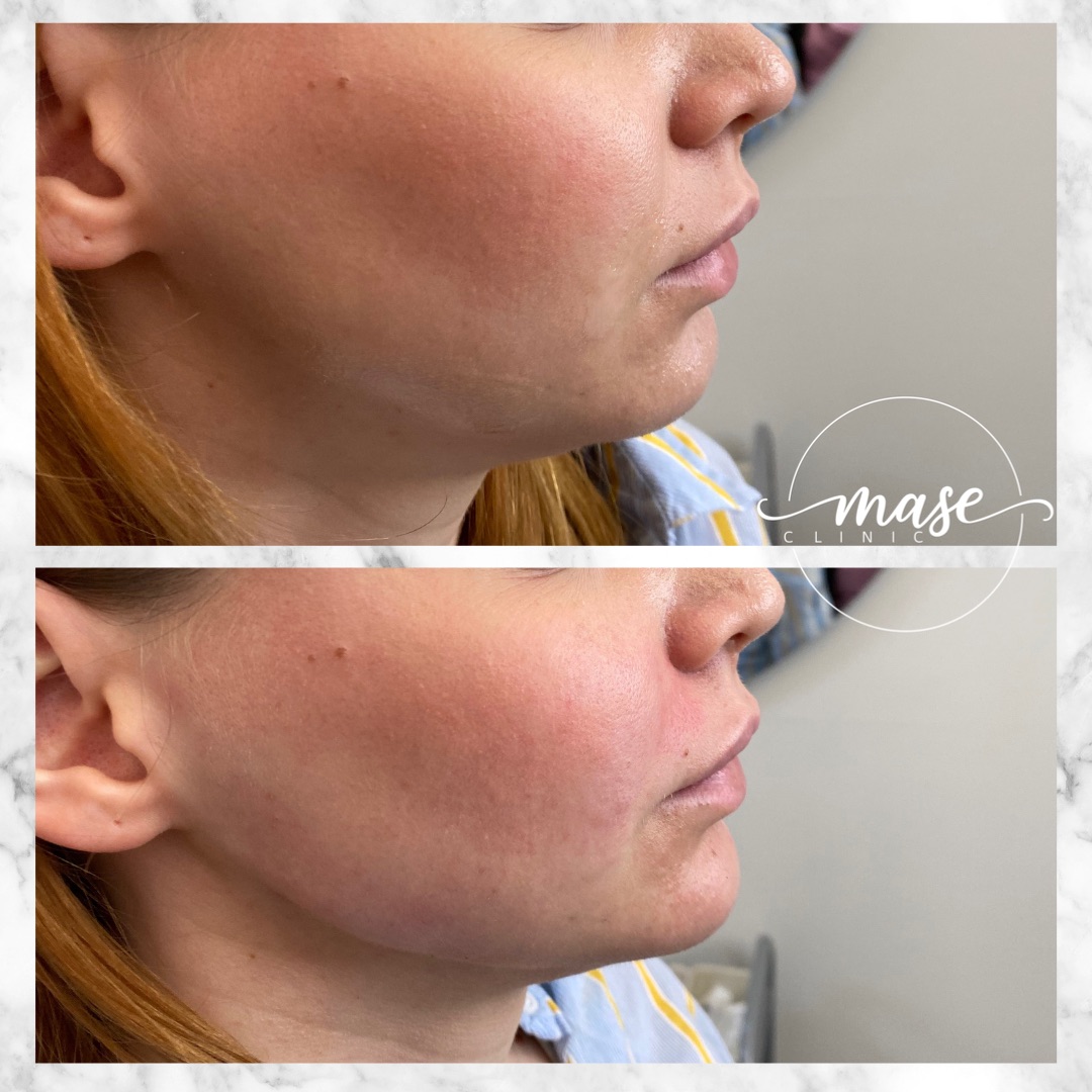 Mase Clinic, Stockholm Bokadirekt