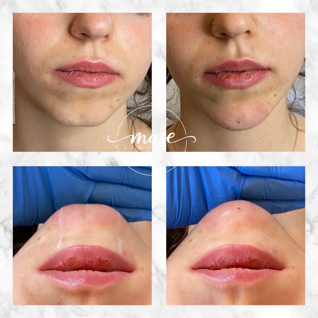 Mase Clinic, Stockholm Bokadirekt