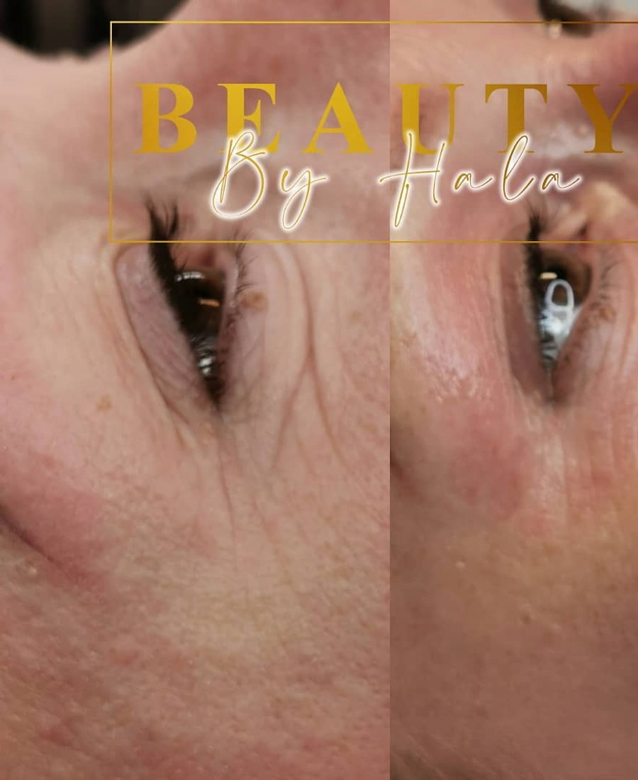 Behandlingsrum hos Beauty by Hala
