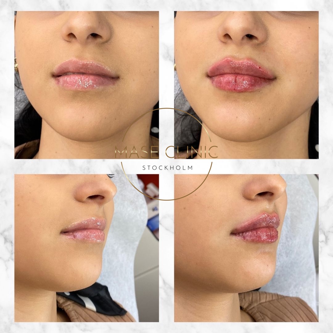 Mase Clinic, Stockholm Bokadirekt