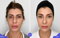 ShapeBy Stockholm - Fillers, Hudvård, Laser hårborttagning mm.